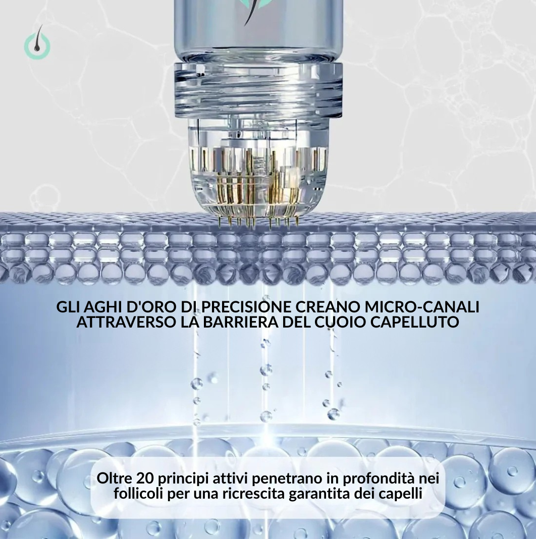 Sistema di microinfusione multi-peptidica  e adenosina per la caduta dei capelli