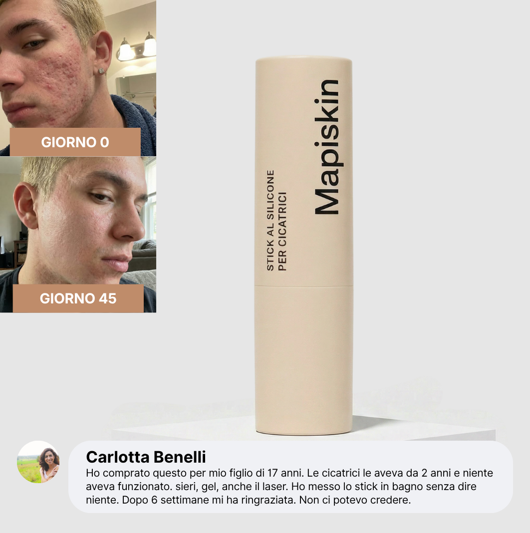 Stick Clinico per Cicatrici da Acne™