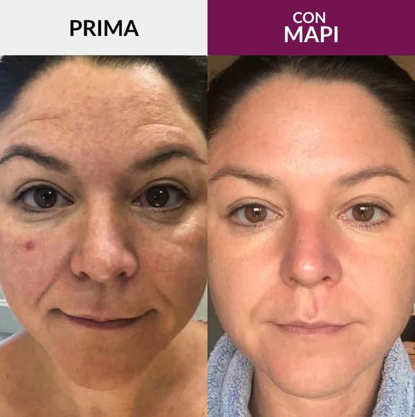 Martina C, 36