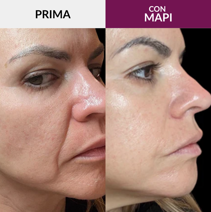 La crema che riempie le rughe dall'interno