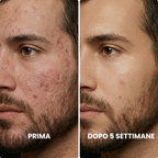 Stick Clinico per il Rimodellamento delle Cicatrici da Acne™