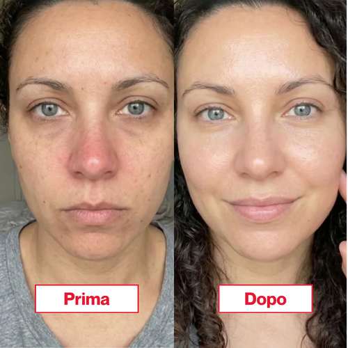 Crema Viso Notte Anti Età